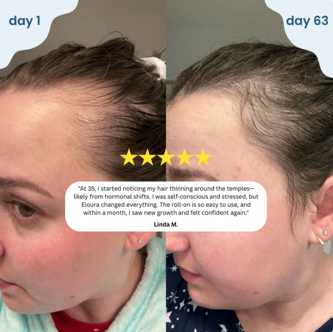 Roll-On Hair Growth Serum™