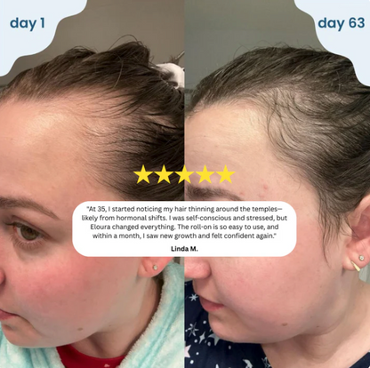 Roll-On Hair Growth Serum™